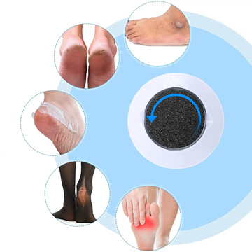 SoftFeet - Pele Macia e Livre de Rachaduras