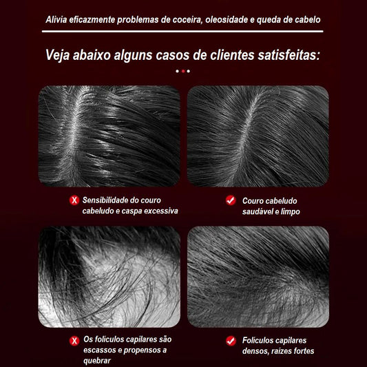 HairVibe – Escova Massageadora para Cabelo e Couro Cabeludo